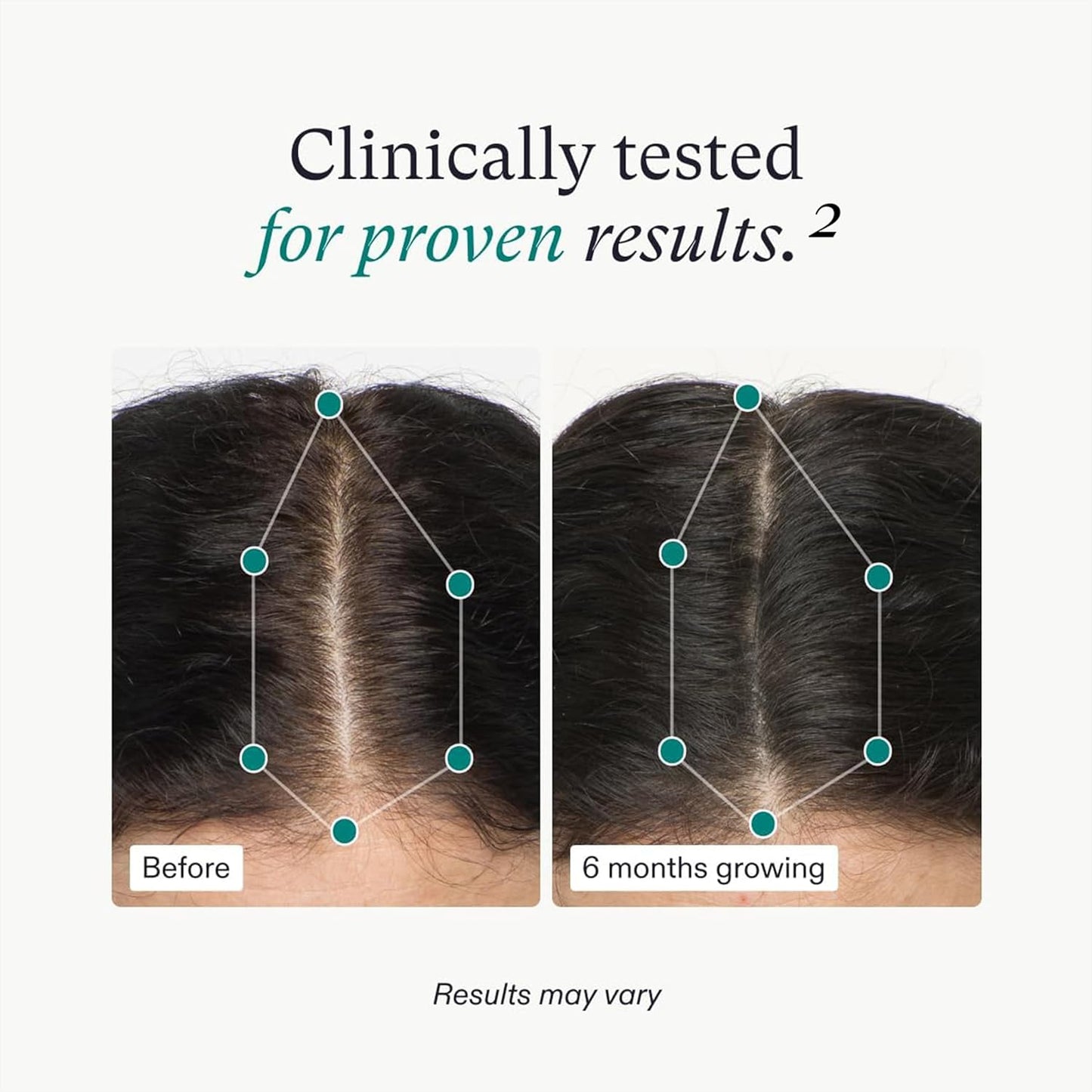 Nutrafol Women's Hair