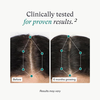 Nutrafol Women's Hair